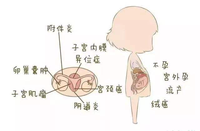 子宮肌瘤是一種激素依賴性腫瘤