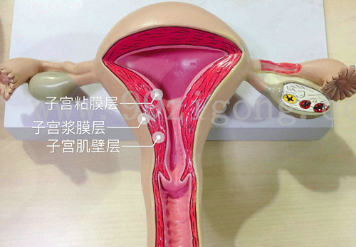 婦科“第一瘤”——子宮肌瘤