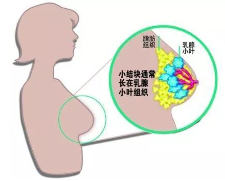 有吸煙習慣的人患胰腺癌的可能性是不吸煙的人的2至3倍