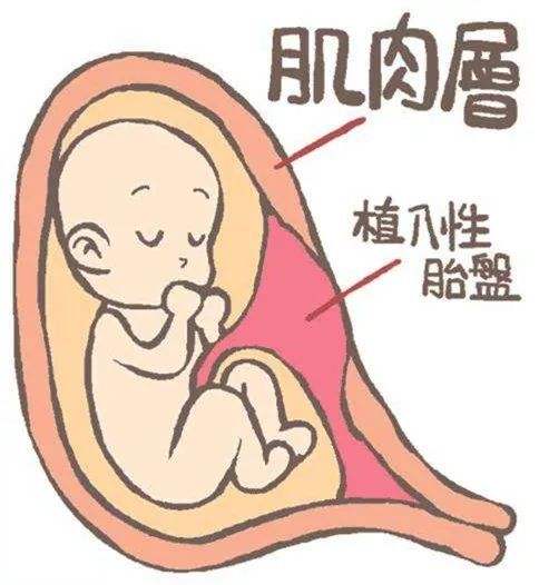 有關子宮肌瘤的病因迄今仍不十分清楚