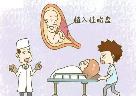 什么是胎盤植入？